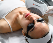 Коррекция акне