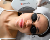 Коррекция эстетических сосудистых патологий