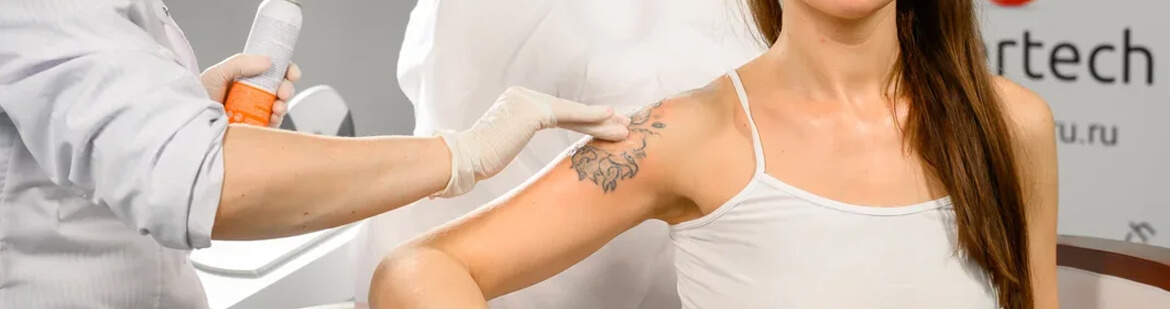 Выведение татуировки йодом