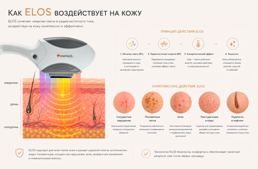 ELOS технология