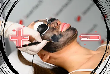 Проведение карбонового омоложения