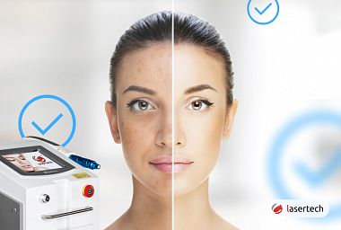 Игольчатый РФ (RF) лифтинг лица плюсы и минусы